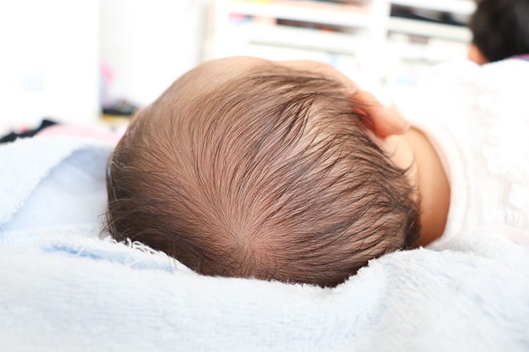 赤ちゃんの頭のかたち外来