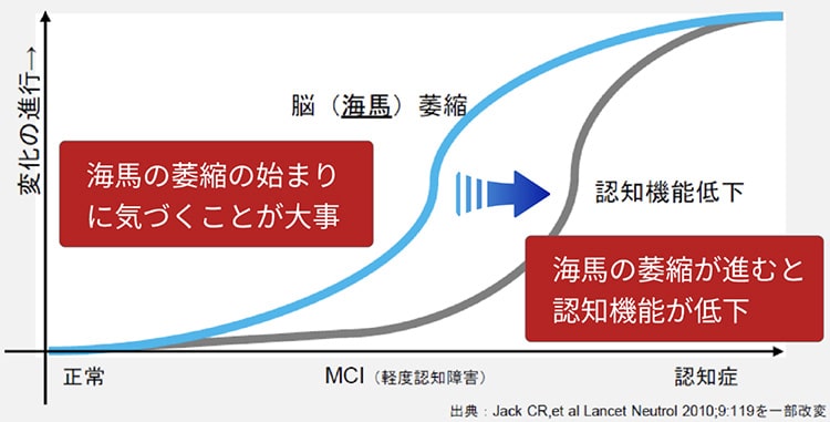 BrainSuite®(ブレインスイート)